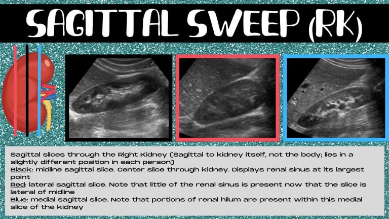 Do Ultrasound Techs Know When Something is Wrong