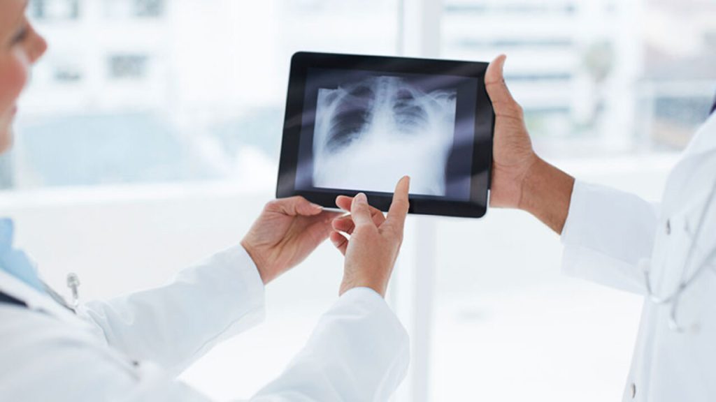 How Do You Become an Xray Tech