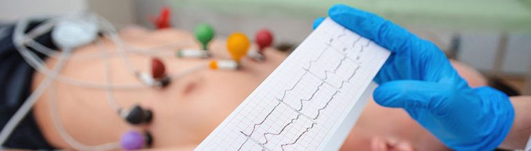 How Long Does It Take to Become an Ekg Tech