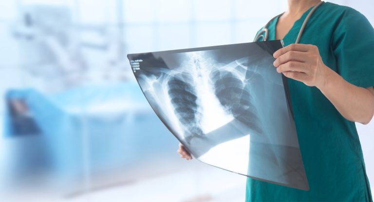 What Do You Need to Be an Xray Tech