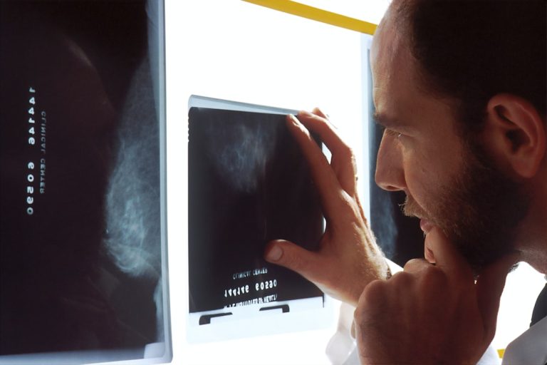What Does an X Ray Tech Do: Essential Roles Explained Clearly